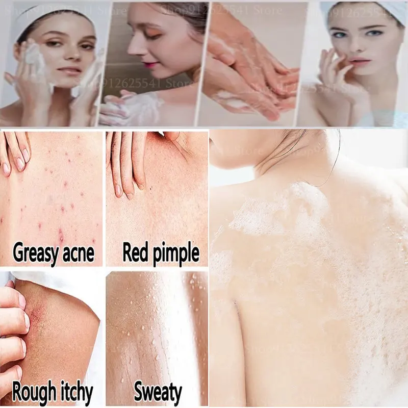 300ml Sulfur Anti-mite Liquid Soap Lasting Itching Oil Control Acne Moisturizing Net Mite Antibacterial Cleaning Wash Shower Gel