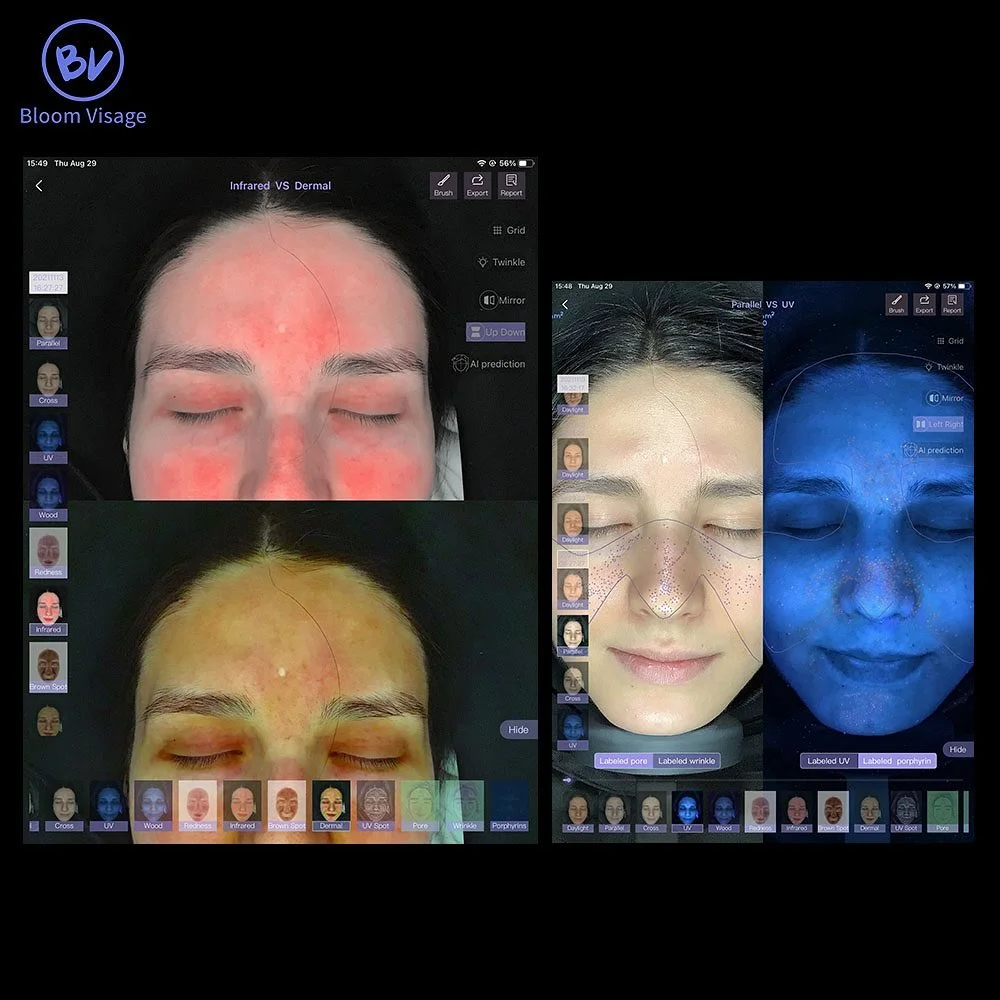 BV 3D AI 피부 분석기 매직 미러 얼굴 스캐너 지능형 피부 문제 테스트기 미용실 필수 진단 도구