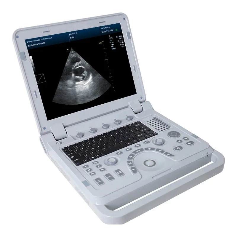 CONTEC CMS1700B doppler portable 3D 4D Echocardiography ultrasound machine