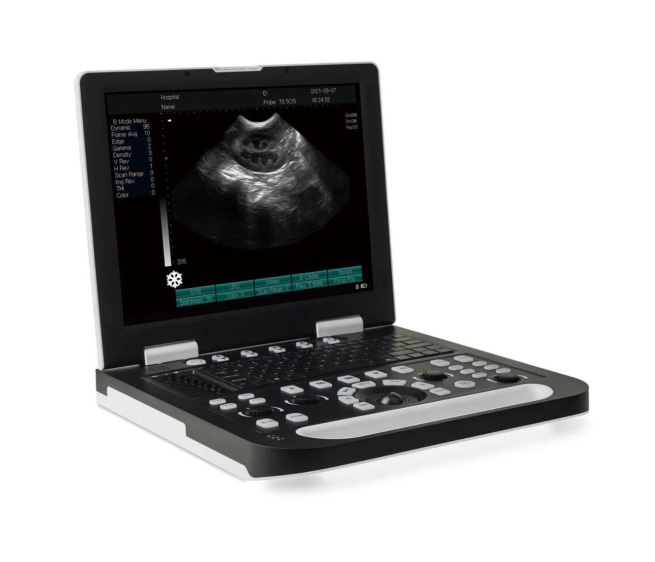 Cheap Portable Animal Medical Equipment Ultrasound Machine Echocardiography Veterinary Ultrasound