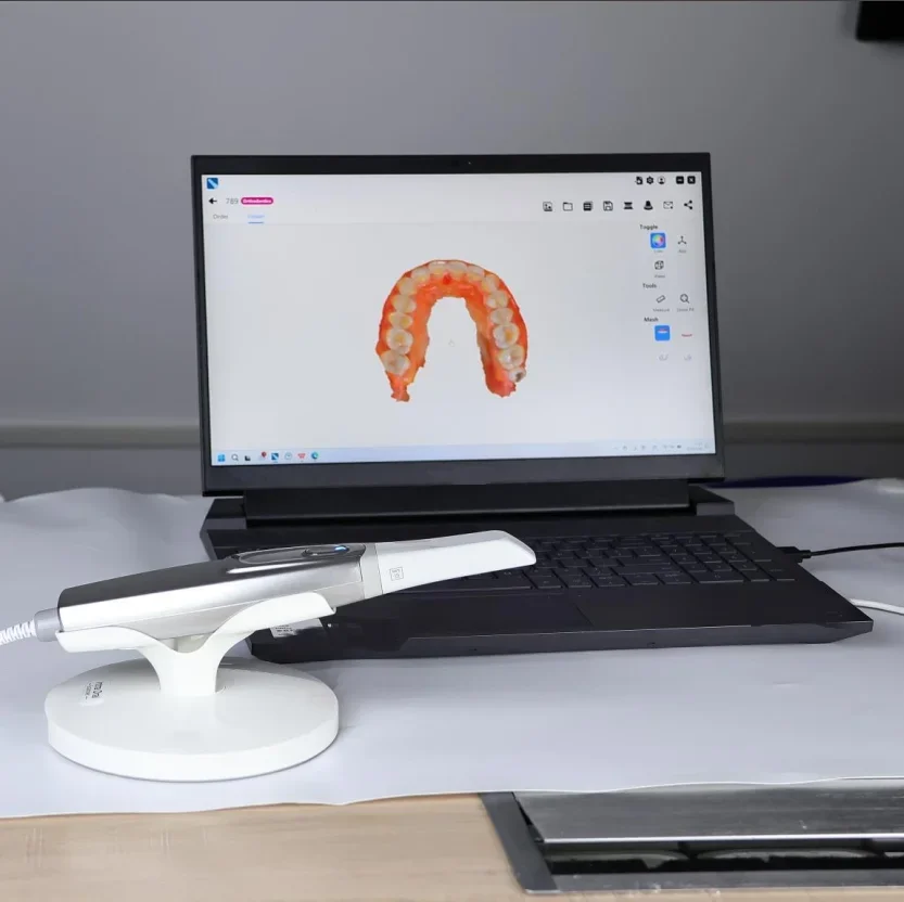 Lodden 3D intra-orale scannerapparatuur Intra-orale scanner Dental Lab Digitaal afdruksysteem CAD CMD Kalibratievrij 2024 NIEUW