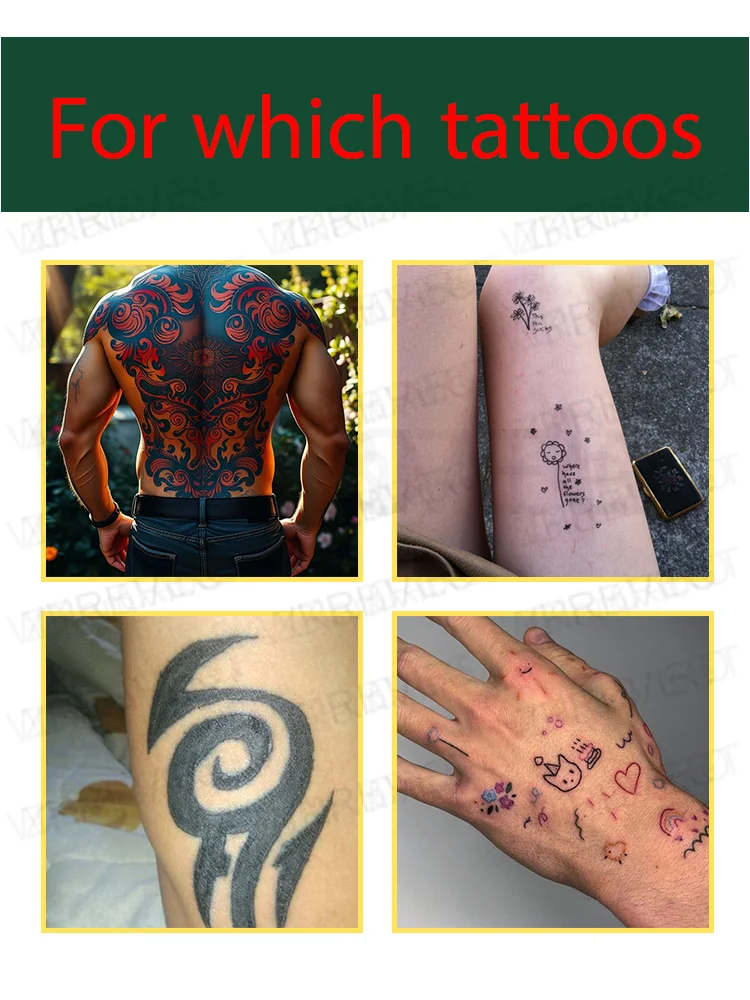 A ʟᴀsᴇʀ ᴘᴇɴ ᴛʜᴀᴛ ᴇғғᴇᴄᴛɪᴠᴇʟʏ ʀᴇᴍᴏᴠᴇs ᴛᴀᴛᴛᴏᴏs