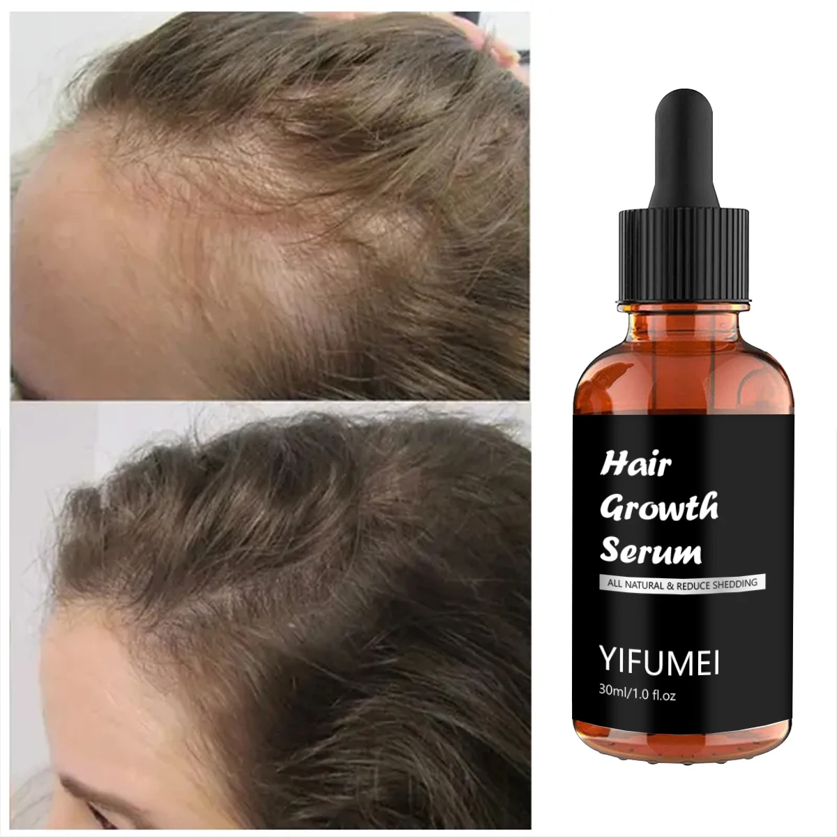 

Anti Hair Loss Treatment for Men and Women - Fast Hair Growth Serum with Scalp Nourishing Properties Beauty Essential Oils