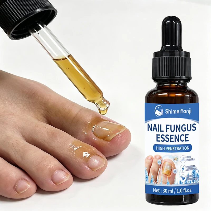 Toe Nail Care Serum: A powerful formula that protects and nourishes nails, ideal for discolored or damaged nails.
