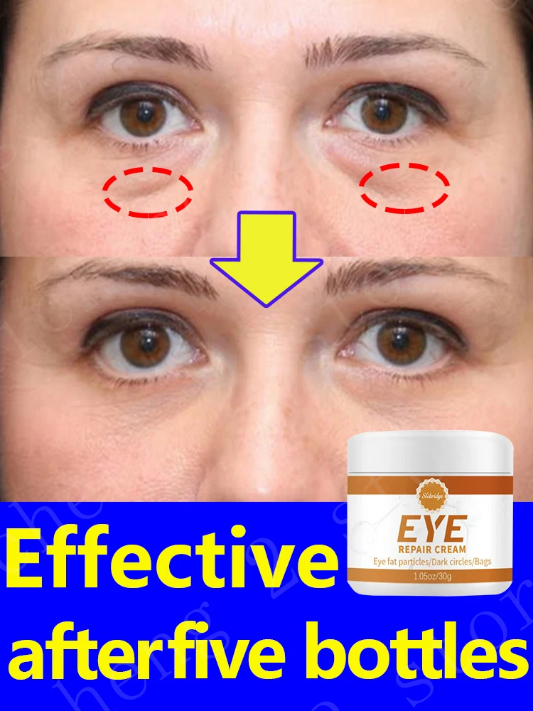 

Eye Care Products