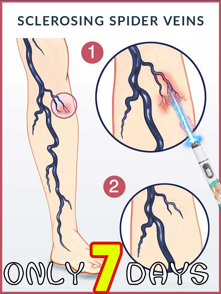 

The latest product is the blue light pen for varicose veins and a leg care tool.
