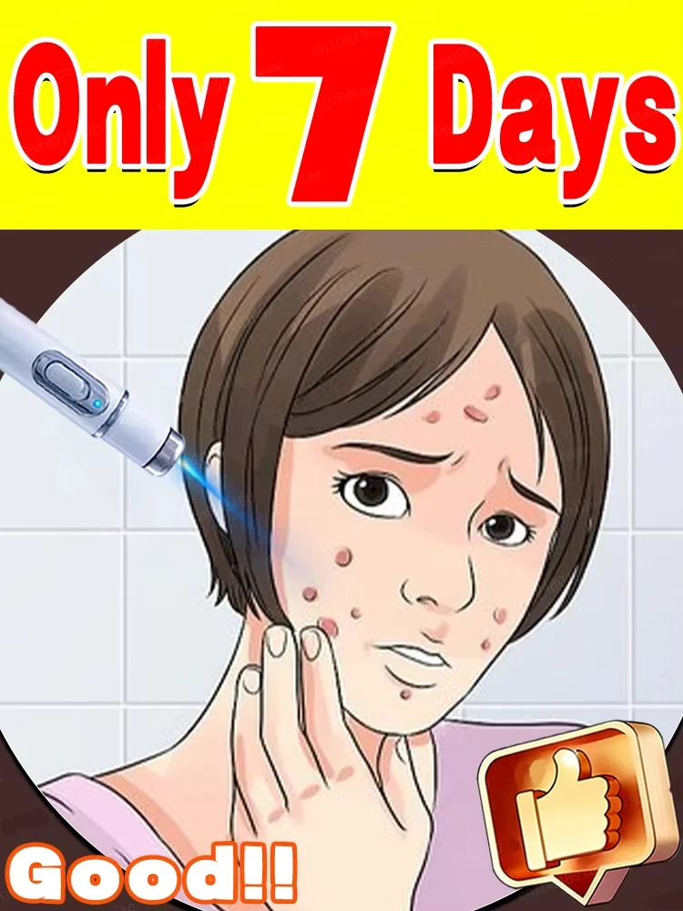 2025 Wart Removal Pen - Safe and Effective, Warts Fall Off Automatically