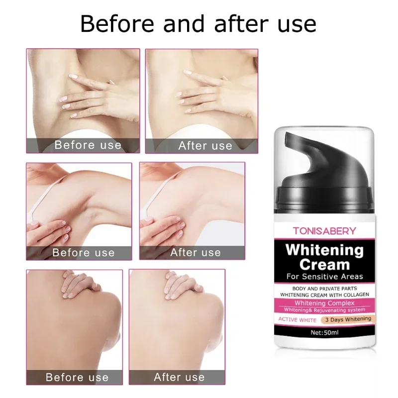 Sdotter New Armpit Whitening Cream Skin Lightening Bleaching Cream For Underarm Elbow Knees Dark Remove Legs Whiten Intimate Bod