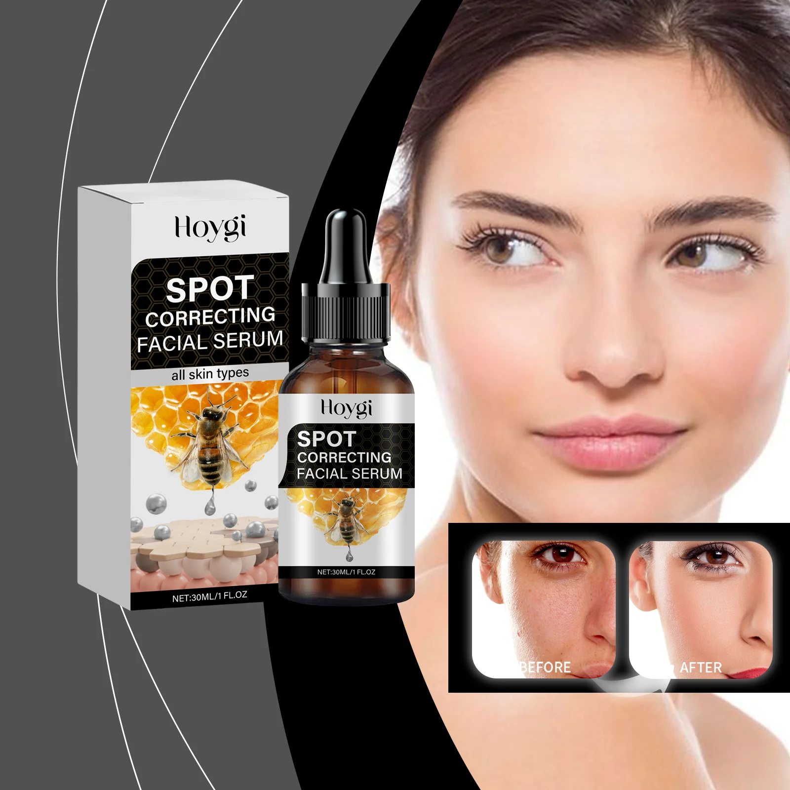 スポット コレクティング フェイシャル セラム - すべての肌タイプのダーク スポット リムーバーとブライトニング トリートメント