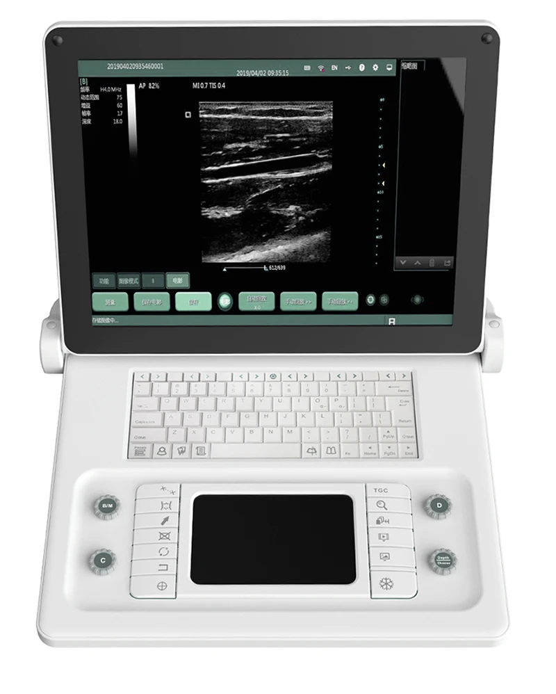 SS-8B B/W Laptop ultrasound System