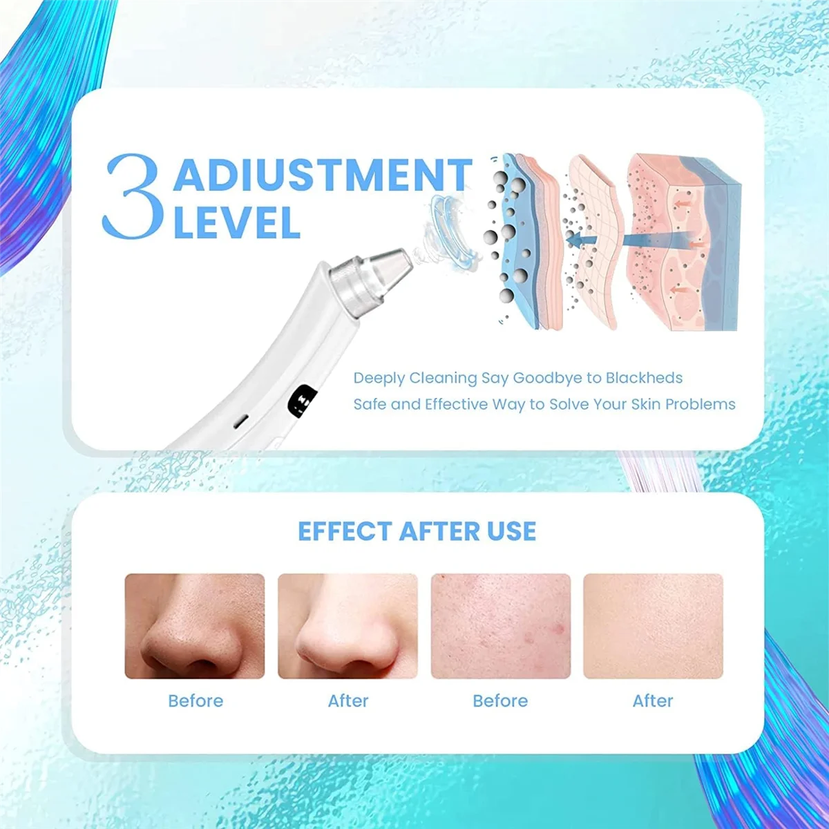 Blackhead Remover Pore Vacuum,5 Suction Power,4 Probes,USB Rechargeable Blackhead Vacuum Kit- Pore Cleaner