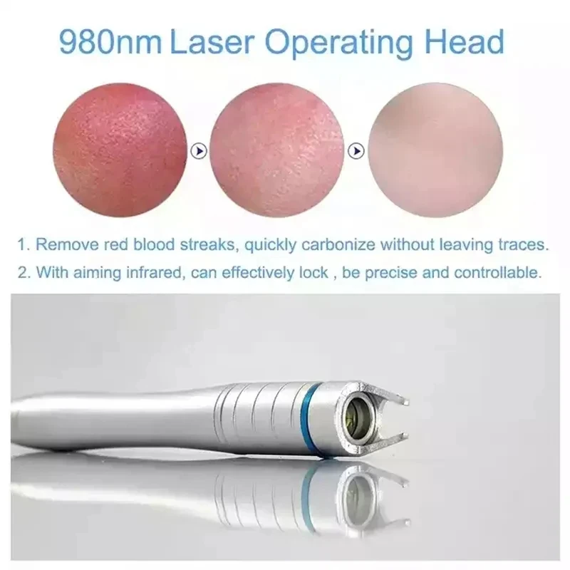 Диодный лазер 980 Нм для лечения грибка ногтей/физиотерапии варикозного расширения вен Lipolisi 980 нм машина для коммерческого использования