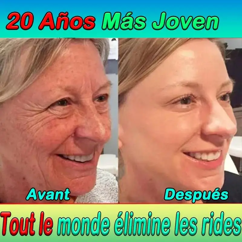 

Крем против морщин Oxys: омолаживающий крем для лица, массажер для лифтинга, средство для удаления морщин, уход за кожей