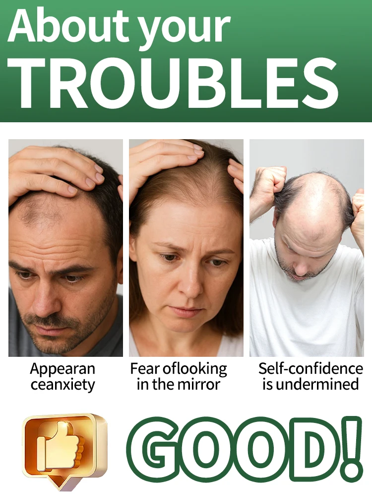 منقذ الصلع، يستعيد شعرك الأسود السميك بسهولة، ويستعيد ثقتك، ويعود إلى ذروة الفراغ #2