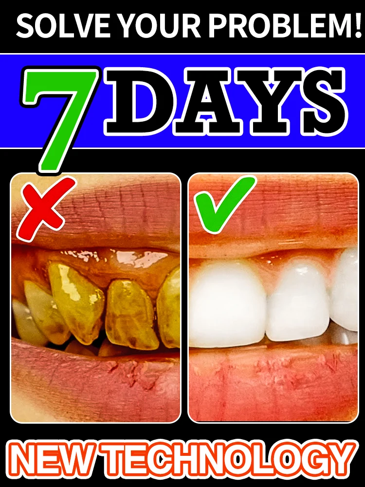 

Instant Whitening Mousse Effectively Targets Plaque & Stains