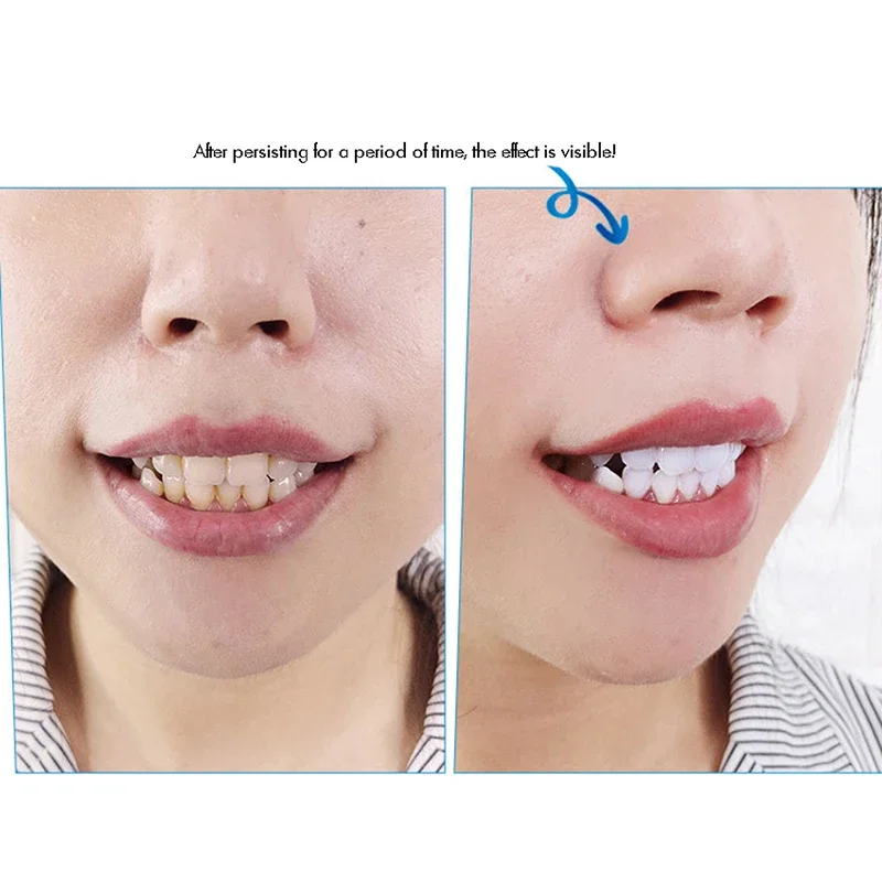 Pasta de dientes para blanqueamiento dental, polvo abrillantador de dientes, elimina las manchas de café, vino, té y aliento fresco, 50g