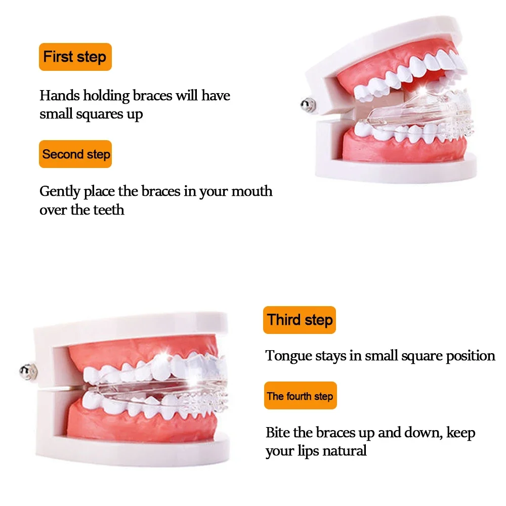 Orthodontische Beugels Tandheelkundige Beugels Smile Tanden Uitlijning Trainer Siliconen 3 Fasen Tanden Trainer Voor Volwassenen Tand Correctie Hulpmiddelen