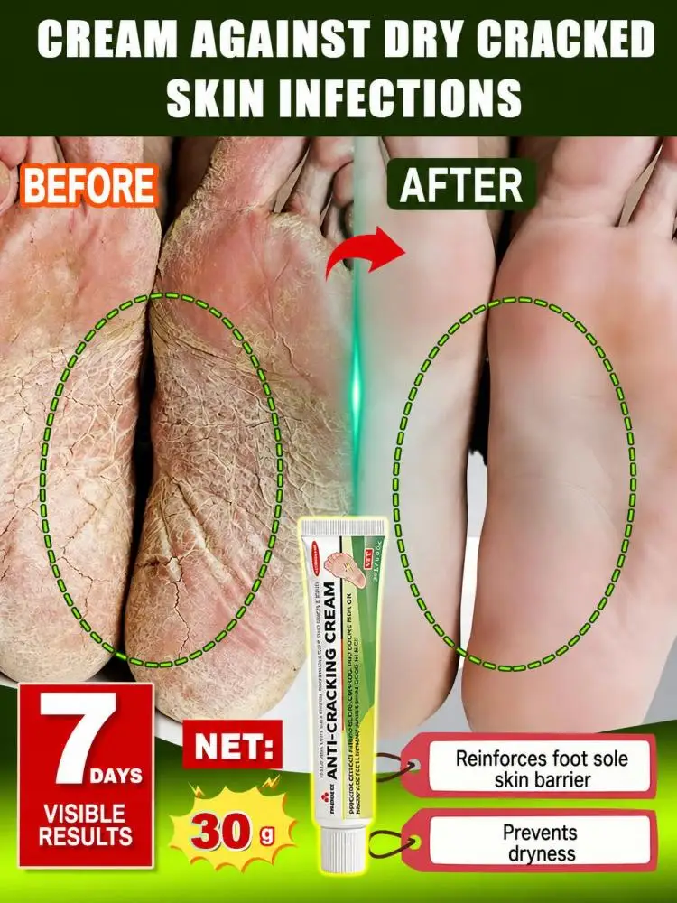 Hand Foot Moisturizing Repair Cream, Gentle Skin Care Balm for Dry Rough Skin, Soften Cuticle, Lock Skin Moisture, Relieve Dry Tightness for Elbow Heel Daily Skin Care