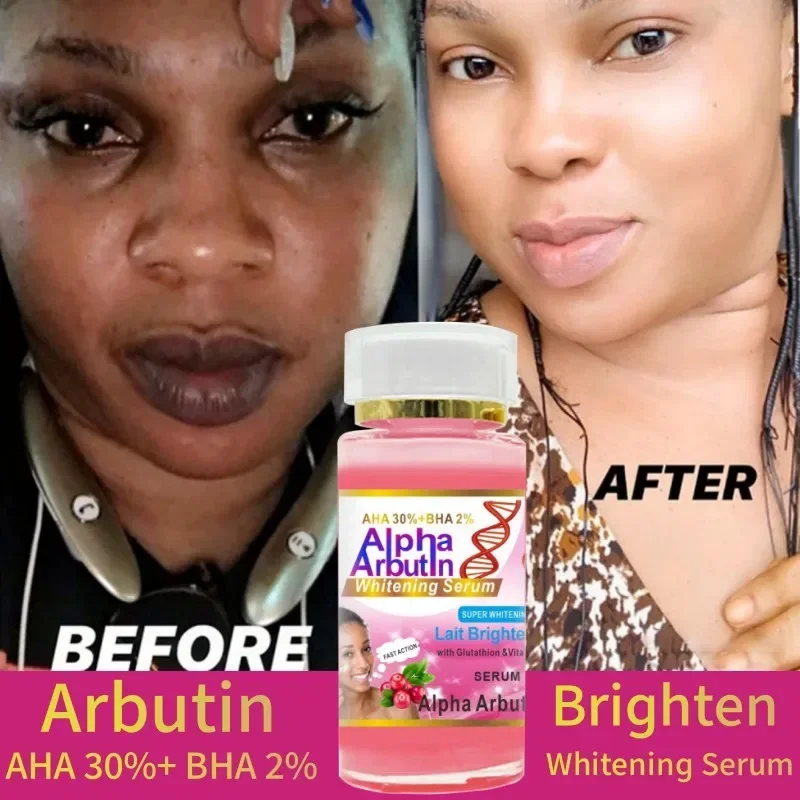 

Alpha Arbutin Serum AHA 30%+ BHA 2% Keeps Face Smooth Brightening Moisturizing Improving Dullness Dark Skin Beauty Care Cream