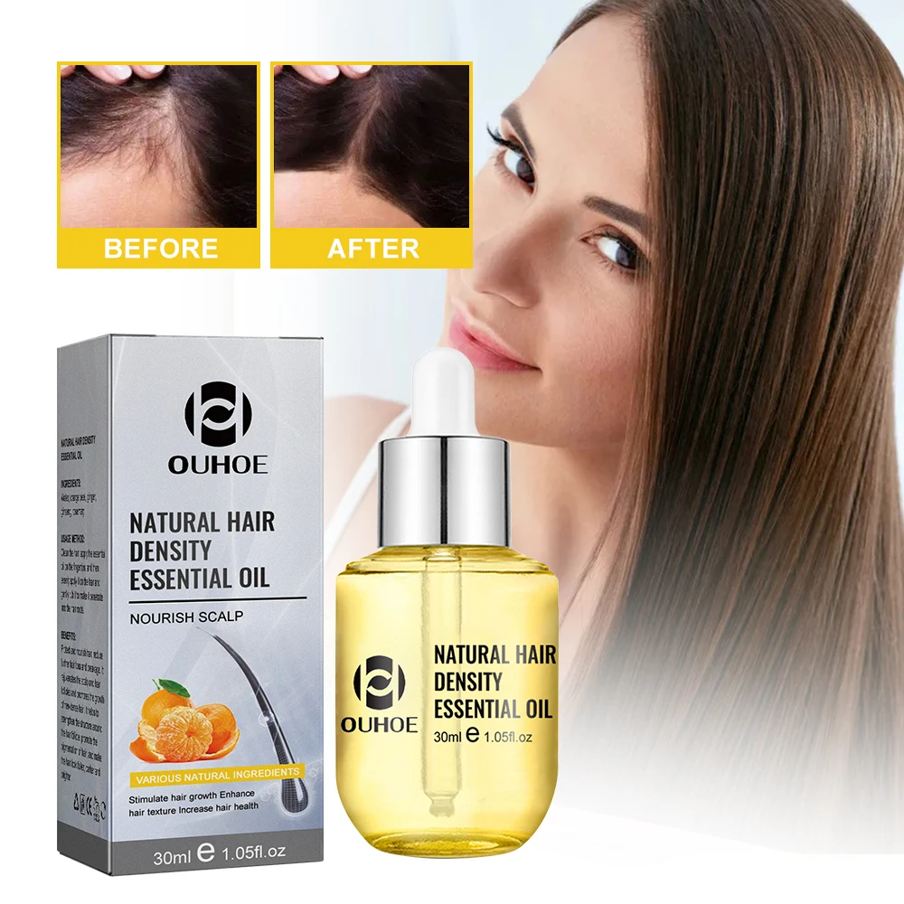 

Hair Thickening Essential Oil 30ml Hair Care Essence Moisturizes Hair Dense Hair Repair Hair Roots Repairs Damaged Hair and