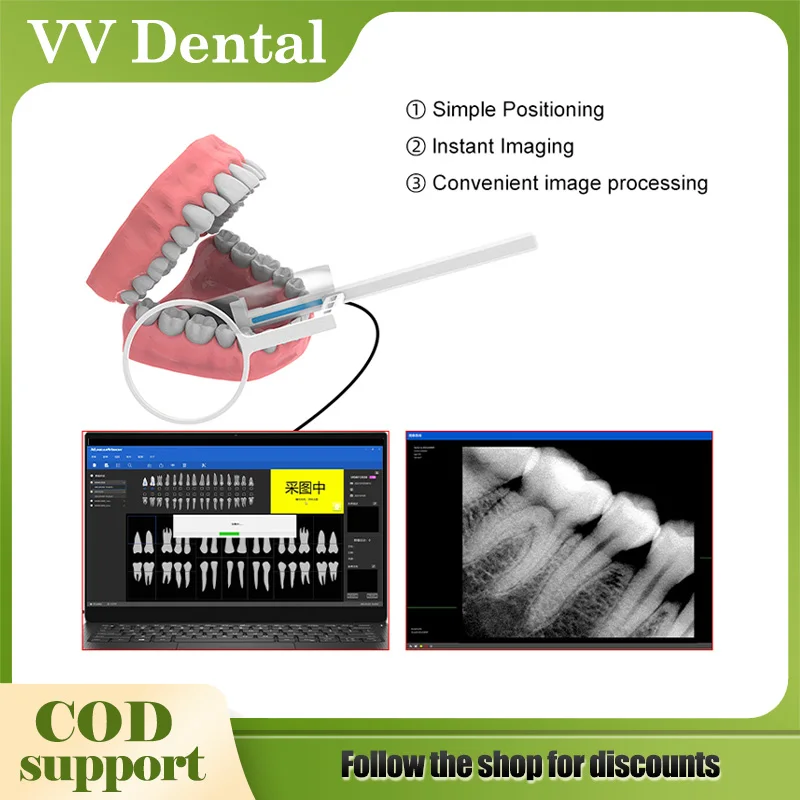 Стоматологический датчик с держателем, быстрый/переработка/прочный USB-стоматологический рентгеновский датчик, внутренняя оральная камера, цифровой датчик RVG