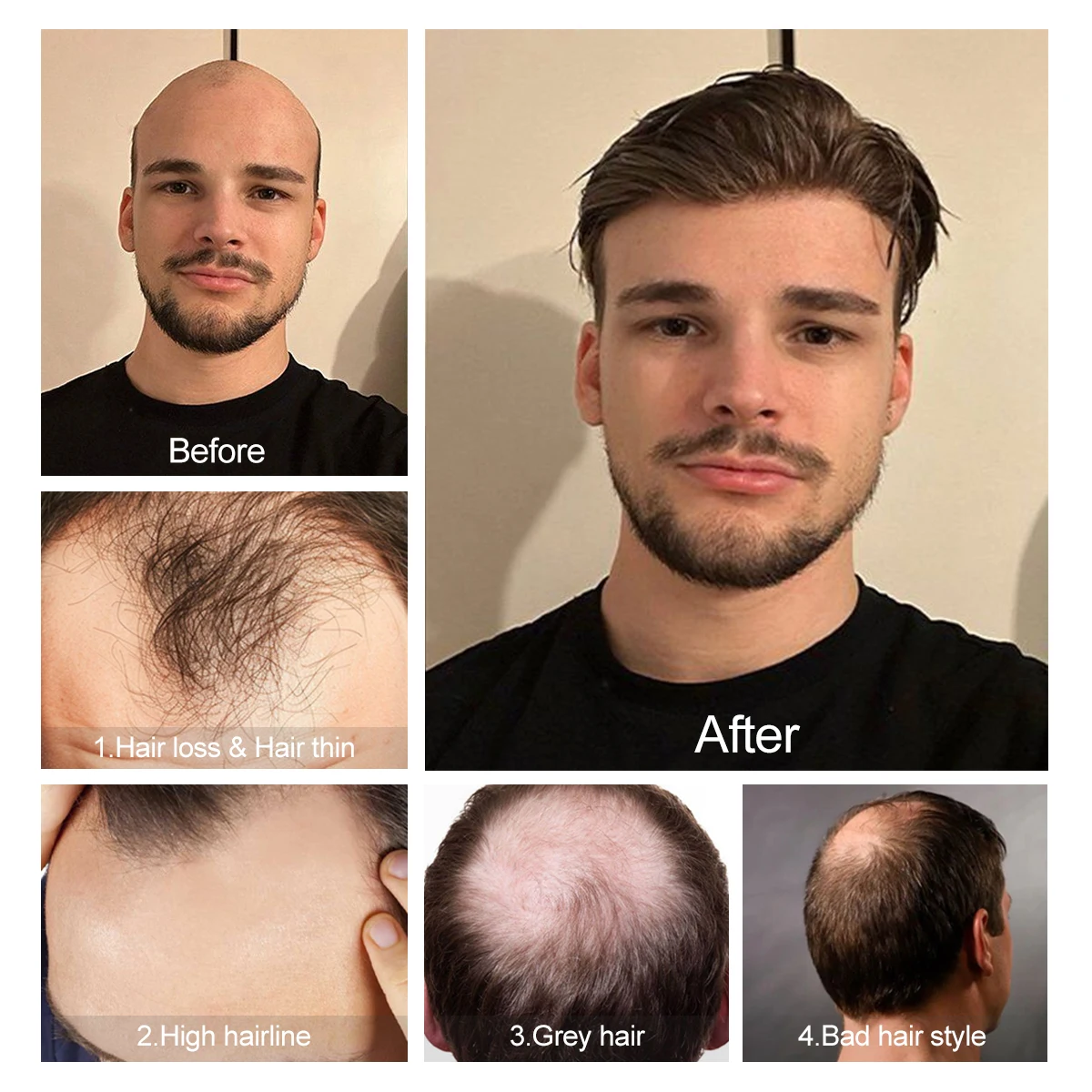 الرجال أمامي الشعر المستعار مستقيم الخامس نمط خط الشعر الأمامي للرجال الشعر البشري رقيقة جدا الجلد بولي Men الرجال الشعرية الاصطناعية الاستخدام اليومي