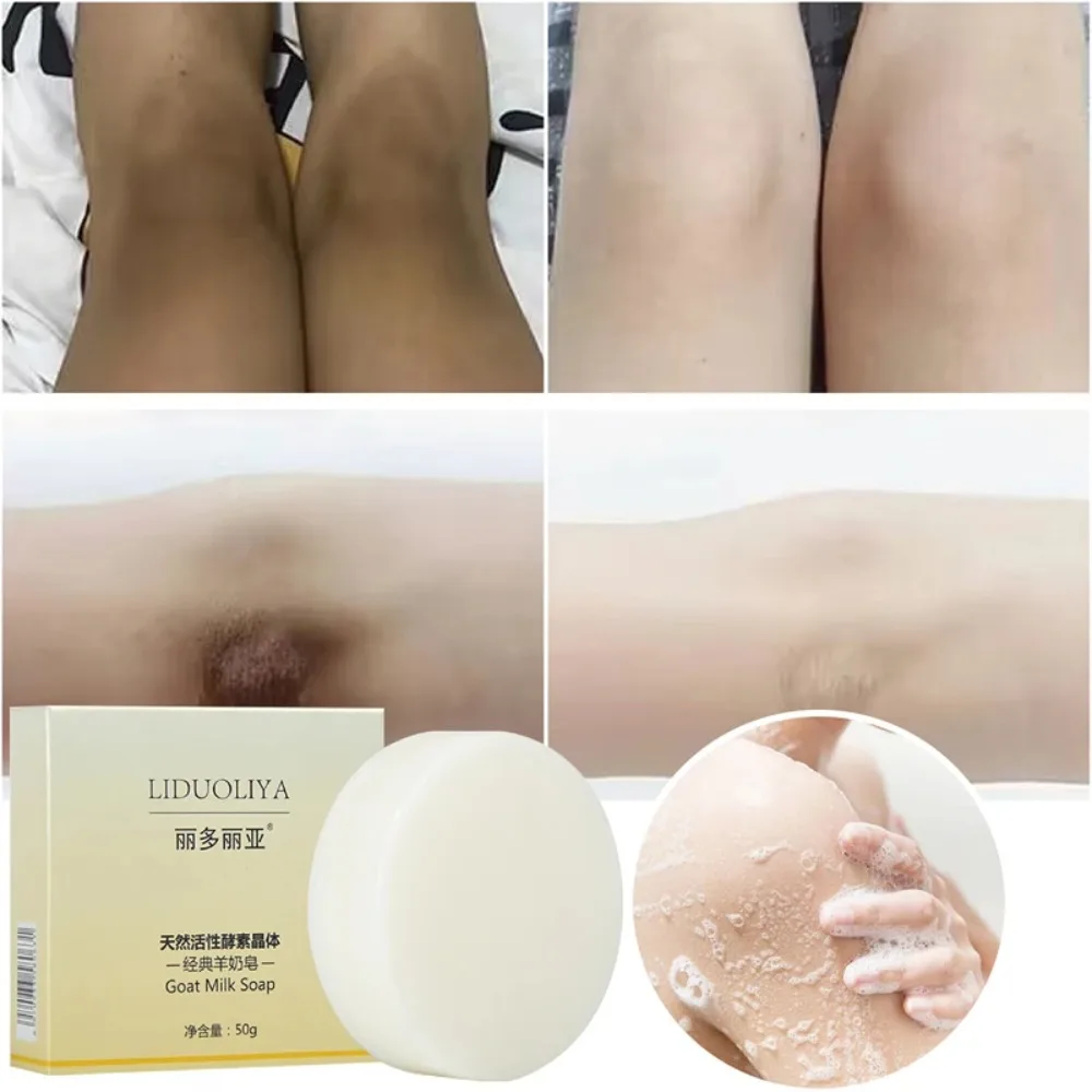 Chicken Skin Removal Body Whitening Soap Removal Dead Skin Moisturizing White Care Products Deep Clean Body Brighten