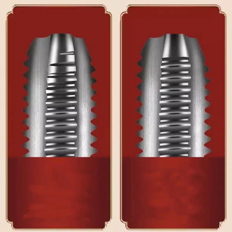 1 Satz hss Handhahn satz = 2 Stück gerader Hahns atz m2m3m4m5m6m8m10m12m14m16m18m20m22m24m27m30