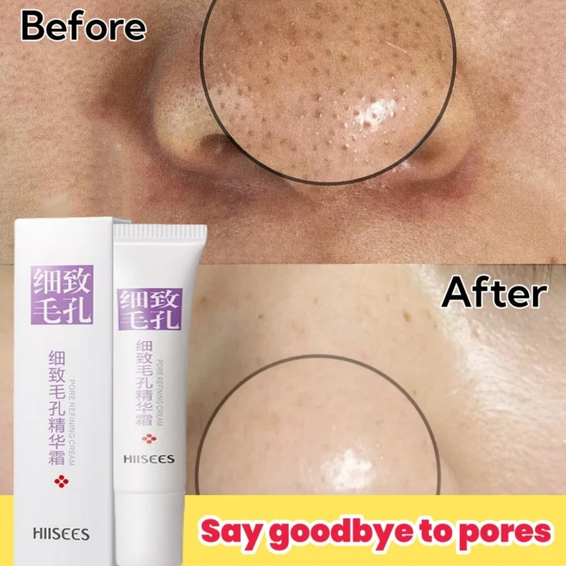 

Salicylic Acid Pore Shrinking Cream Quick Elimination Large Pores Smooth Skin Remove Blackehead Tighten Face Korean Care Product