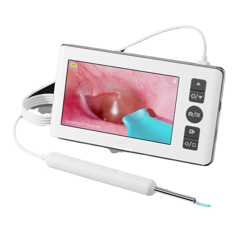 WORTHOWN-Otoscopio Digital con cámara de alcance de oreja de 3,5 Mm con 6 luces 1080P 4,3 pulgadas IPS herramienta de eliminación de cera de oído