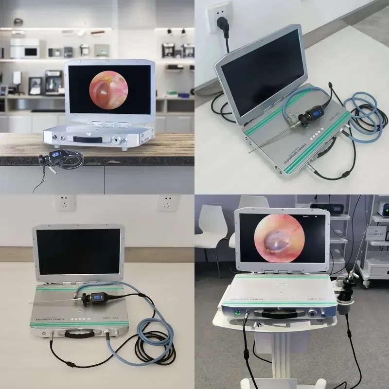 17inch 4 in 1 Medical Equipment System All in One Portable