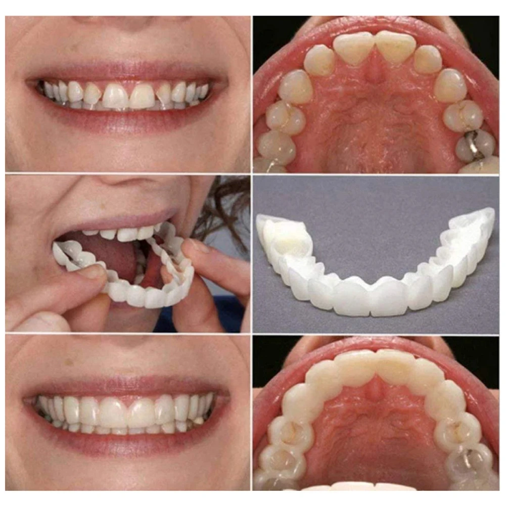 5Upper Lower Cosmetic Teeth Veneers — Temporary Snap-On Coverck848