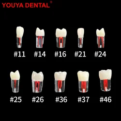 Youya-modelo de entrenamiento de Canal radicular Dental, dientes endodónticos, simulación de odontología, práctica RCT, cavidad de pulpa, modelo de estudio de enseñanza, 1 piezas