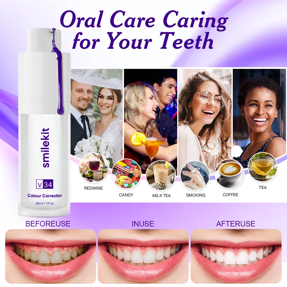 Smilekit-dentes branqueamento creme dental roxo, Mousse Dental Care for Teeth, clareamento branco, dente reduzir amarelecimento