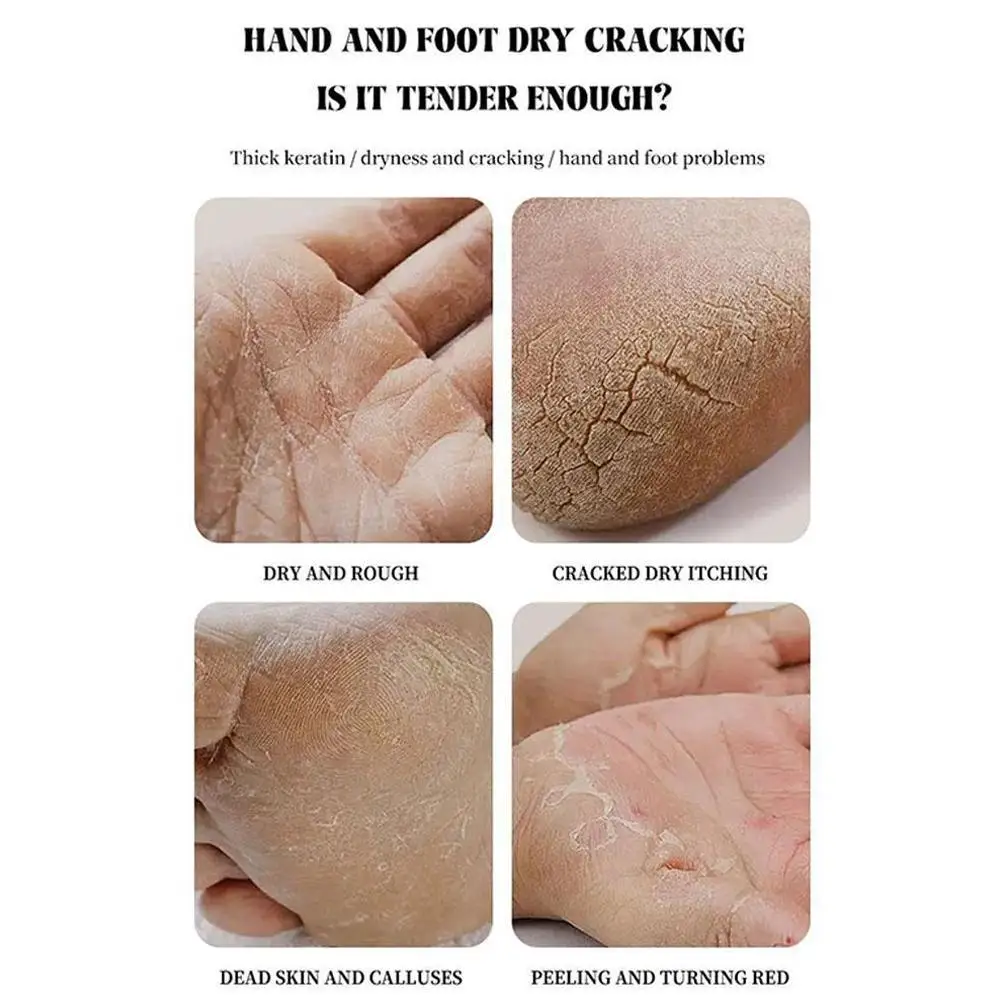 Anti-Drying Crack Foot Cream Heel Cracked Repair Cream Removal Dead Skin Hand Feet Care Hand and Foot Skin Care