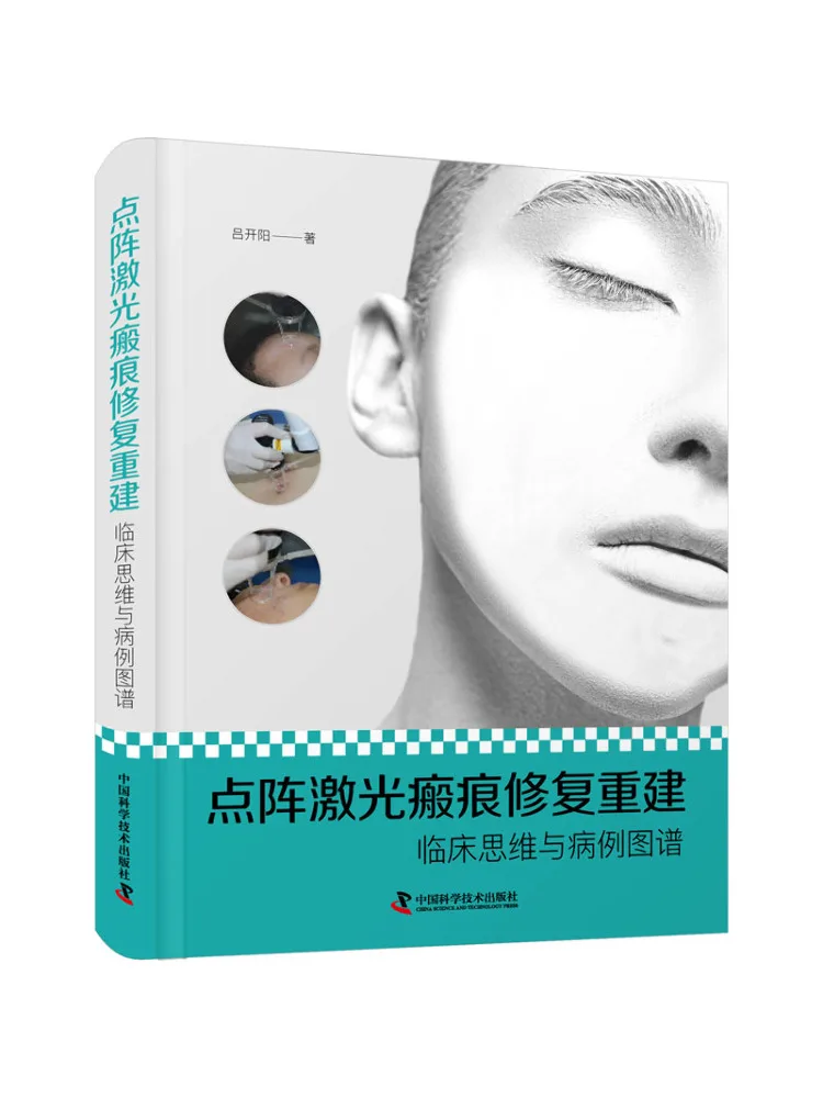 

Book-Winshare Dot Matrix Laser Scent Repair and Rebuild Clinical Thinking and Cases Map