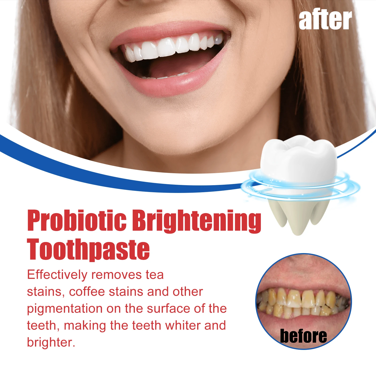 Oralhoe Probiotic Brightening Toothpaste, Oral Cleaning Remove Odor Stains White Teeth Gum Care Toothpaste