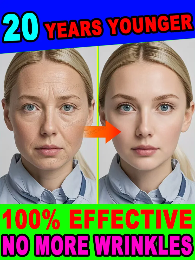 

Подходит для всех типов кожи. Морщины, 20-летний младший.