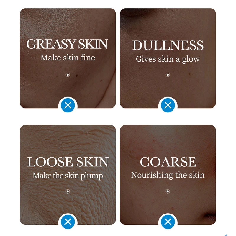 SADOER 5-Piece Ice Face Masks 3