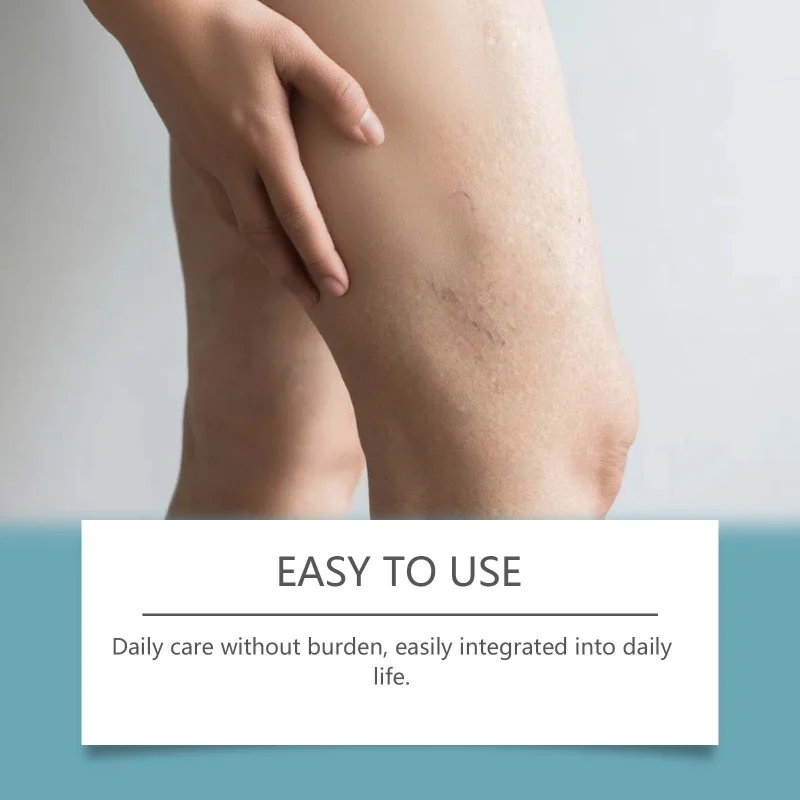 علكات وكبسولات نسائية تغذي ومرطبة تحمي مرونة البشرة وتحسين البشرة وتعزيز المرونة للياقة البدنية #3