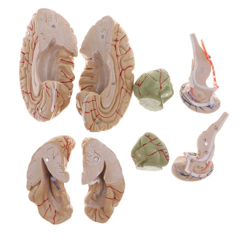 1:1 Menselijk Gekleurd Hoofd Modaal 8 Delen Hersenstam Slagaders Model