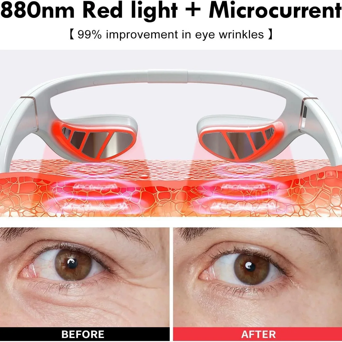 EMS微電流アイケアデバイス 目元マッサージ器 美容液注入デバイス 美容目元機器