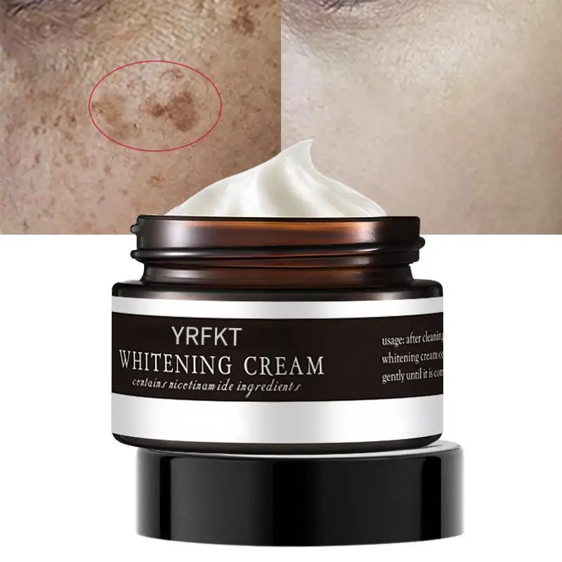Whitening Freckle Face Cream Remove Melasma Cream Dark Spots Melanin Nicotinamide moisturizing Brightening Skin Care