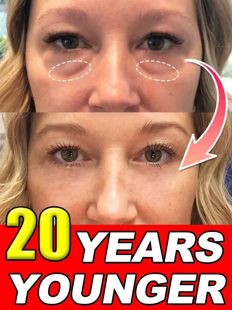 Instant Eye Bag Remover Gel-Cream Erase Bags Under Eyes | Dark Circle Corrector | 7 Days Visible