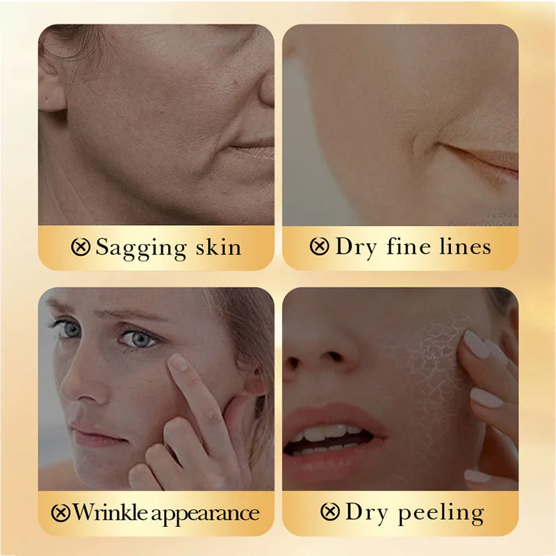 SADOER خميرة الكولاجين المضادة للتجاعيد كريم وجه ترطيب مكافحة الشيخوخة تبييض كريم وجه لمنتجات العناية بالبشرة الوجه