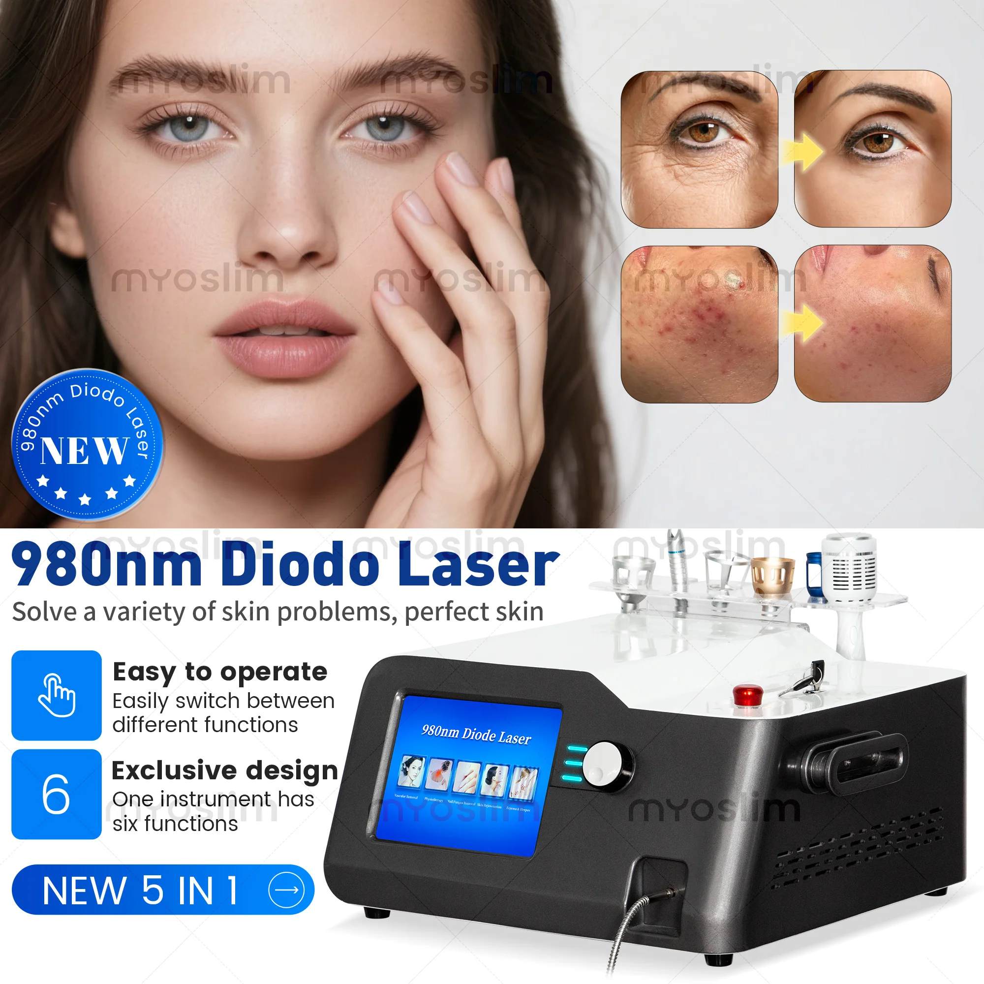 5-in-1 980nm Diode Lase Vascular Vein Removal Nail Fungus Removal Device Instrument Skin Fungal Infection