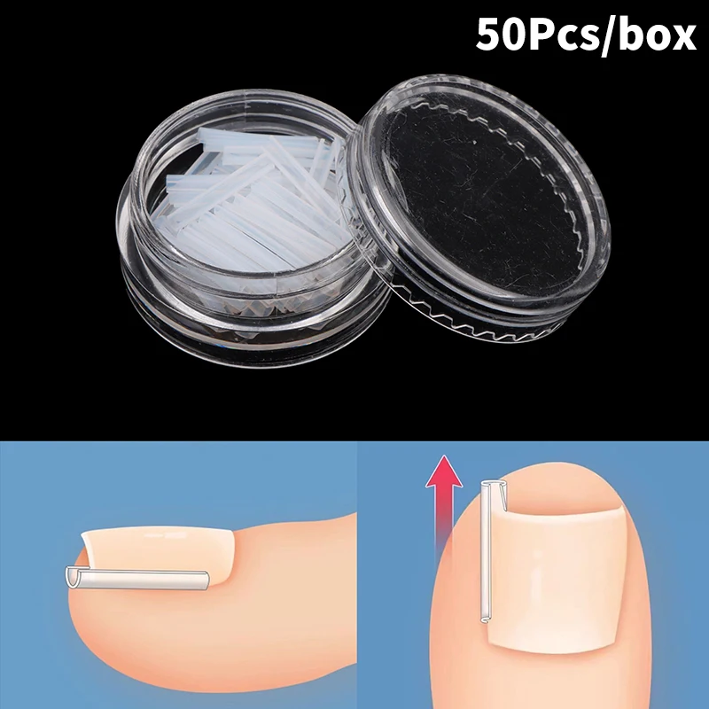 50Pcs/Box Ingrown Toenail Correction Strips Paronychia Correction Straightening Brace Toe Nail Treatment Groove Pedicure Tools