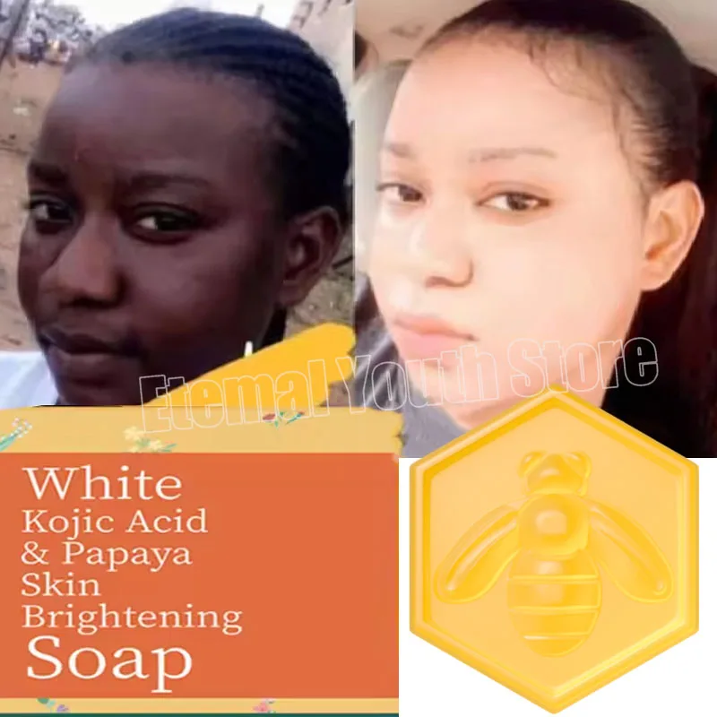 Body Whitening SOAP Deep Clean Skin สบู่กําจัดผิวไก่รักแร้ใต้วงแขนเข่า Bleaching Body Brighten White Care ผลิตภัณฑ์