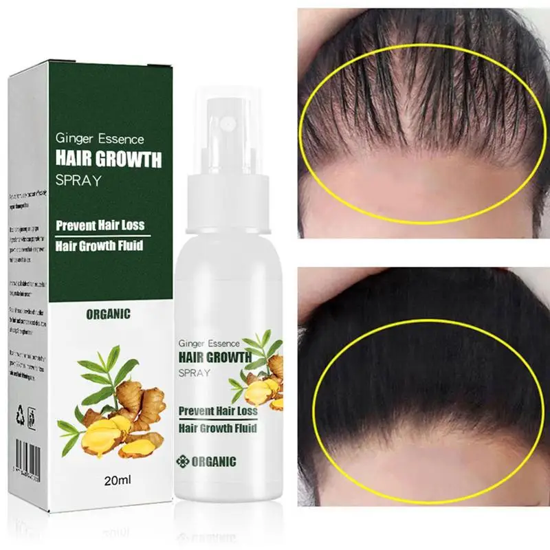 

20ml Ginger Hair Growth Spray Volume Lift Root Booster Hair Essence Thickening Spray For Hair Moisturizing Ginger Natural Scalp