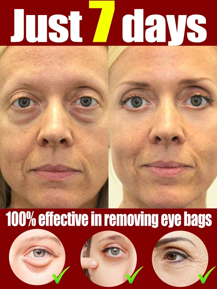 

Repairing problems around the eyes